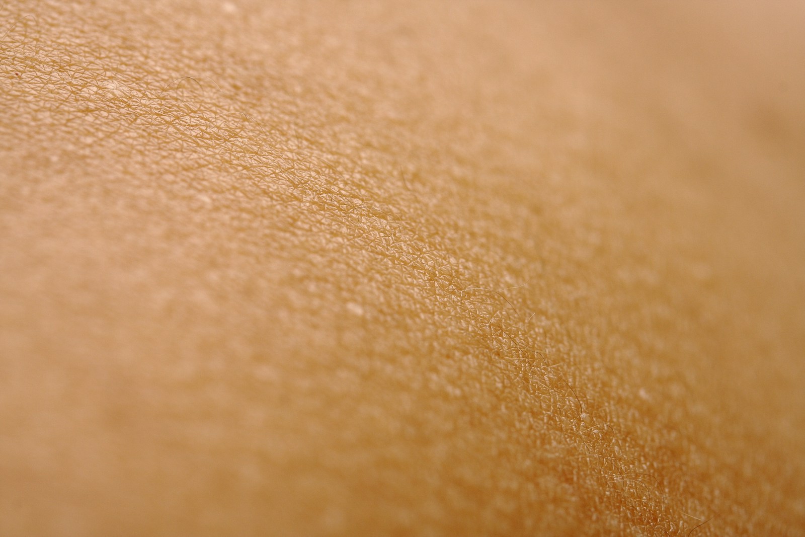 Macro photograph of untreated skin showing natural pore and surface texture.