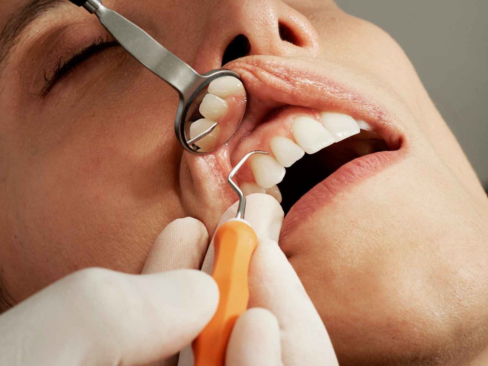 Cận cảnh bác sĩ dùng gương nha khoa và cây thăm dò kiểm tra hàm răng trên của bệnh nhân đang há miệng